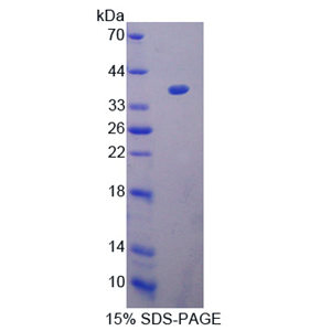 热休克蛋白40(HSP40)重组蛋白