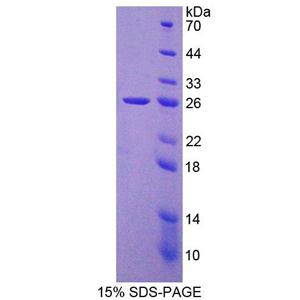 染色质装配因子1亚基B(CHAF1B)重组蛋白
