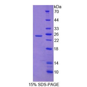 染色质域解旋酶DNA结合蛋白5(CHD5)重组蛋白