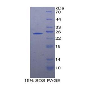 染色体结构维持蛋白3(SMC3)重组蛋白