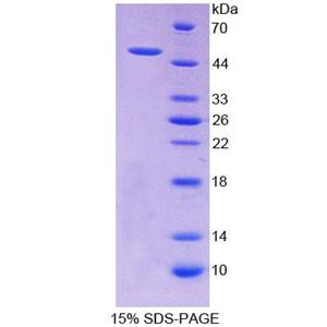 醛脱氢酶1家族成员A2(ALDH1A2)重组蛋白,Recombinant Aldehyde Dehydrogenase 1 Family, Member A2 (ALDH1A2)