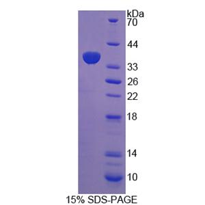 全细胞色素C合酶(HCCS)重组蛋白,Recombinant Holocytochrome C Synthase (HCCS)