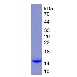 趋化因子C-基元受体1(XCR1)重组蛋白