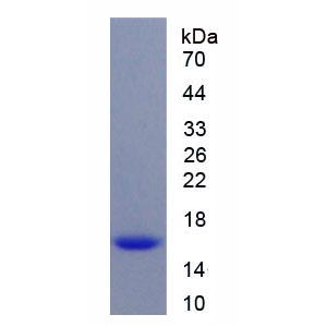 趋化因子C-X-C-基元受体4(CXCR4)重组蛋白