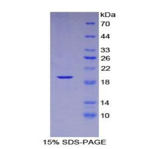 趋化因子C-X-C-基元配体16(CXCL16)重组蛋白
