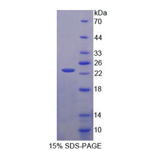 趋化素样因子超家族成员8(CKLFSF8)重组蛋白