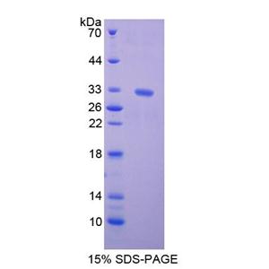 驱动蛋白家族成员5B(KIF5B)重组蛋白
