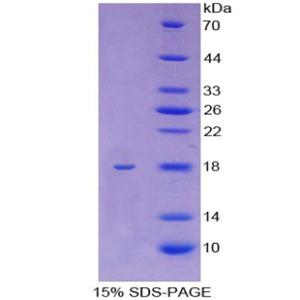 驱动蛋白家族成员5A(KIF5A)重组蛋白