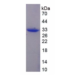 驱动蛋白家族成员1A(KIF1A)重组蛋白,Recombinant Kinesin Family, Member 1A (KIF1A)