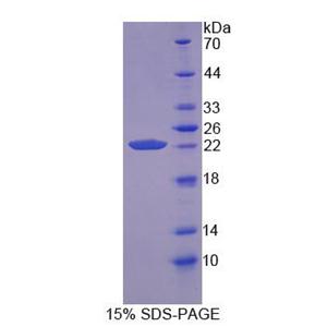 亲环素B(CYPB)重组蛋白,Recombinant Cyclophilin B (CYPB)