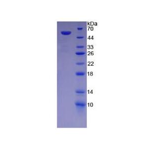 桥粒芯糖蛋白1(DSG1)重组蛋白,Recombinant Desmoglein 1 (DSG1)