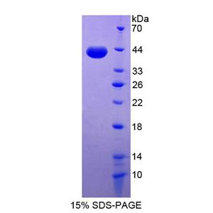 桥粒芯胶粘蛋白2(DSC2)重组蛋白