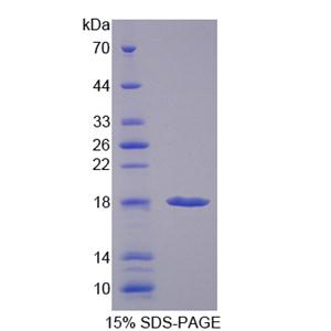 前折叠蛋白亚基1(PFDN1)重组蛋白