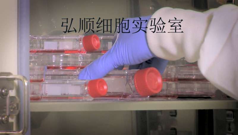 SW1222 Cells|人结肠癌贴壁细胞,SW1222 Cells