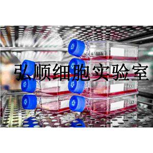 Wien 133 Cells|人非何杰金氏淋巴瘤懸浮細(xì)胞,Wien 133 Cells