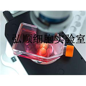 HCC9204 Cells|人肝癌贴壁细胞,HCC9204 Cells