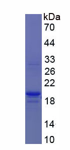 前胶原C端蛋白酶增强子2(PCPE2)重组蛋白,Recombinant Procollagen C Proteinase Enhancer 2 (PCPE2)