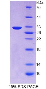 前蛋白转化酶枯草溶菌素1(PCSK1)重组蛋白,Recombinant Proprotein Convertase Subtilisin/Kexin Type 1 (PCSK1)