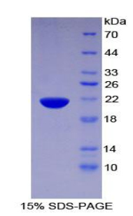 普列克底物蛋白同源物样域家族A成员2(PHLDA2)重组蛋白,Recombinant Pleckstrin Homology Like Domain Family A, Member 2 (PHLDA2)