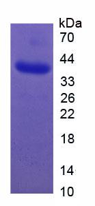 葡萄糖轉(zhuǎn)運(yùn)蛋白2(GLUT2)重組蛋白,Recombinant Glucose Transporter 2 (GLUT2)