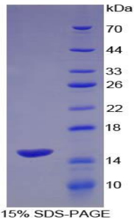 葡萄糖转运蛋白14(GLUT14)重组蛋白,Recombinant Glucose Transporter 14 (GLUT14)