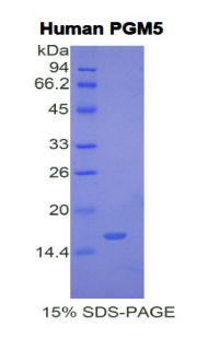 葡萄糖磷酸变位酶5(PGM5)重组蛋白,Recombinant Phosphoglucomutase 5 (PGM5)