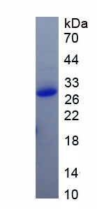 葡萄糖激酶(GCK)重組蛋白,Recombinant Glucokinase (GCK)