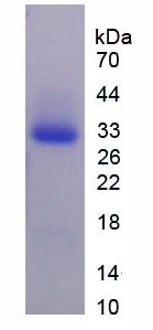 葡萄糖6磷酸异构酶(GPI)重组蛋白,Recombinant Glucose 6 Phosphate Isomerase (GPI)