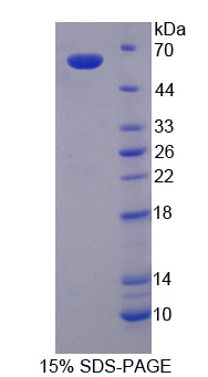 葡萄糖6磷酸脱氢酶(G6PD)重组蛋白,Recombinant Glucose-6-phosphate Dehydrogenase (G6PD)