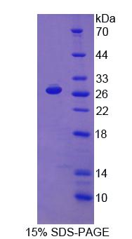 脯氨酸脱氢酶(PRODH)重组蛋白,Recombinant Proline Dehydrogenase, Mitochondrial (PRODH)