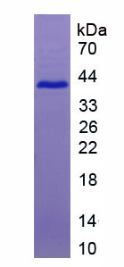 脯氨酸丰富蛋白4(PRR4)重组蛋白,Recombinant Proline Rich Protein 4, Lacrimal (PRR4)