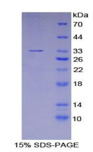 嘌呤能受体P2Y14(P2RY14)重组蛋白,Recombinant Purinergic Receptor P2Y, G Protein Coupled 14 (P2RY14)