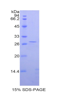 嘌呤霉素敏感性氨肽酶(PSA)重組蛋白,Recombinant Puromycin Sensitive Aminopeptidase (PSA)