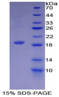 皮敌菌素(DCD)重组蛋,Recombinant Dermcidin (DCD)