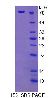 皮层肌动蛋白(CTTN)重组蛋白,Recombinant Cortactin (CTTN)