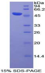 蓬乱蛋白Dsh同源物3(DVL3)重组蛋白,Recombinant Dishevelled, Dsh Homolog 3 (DVL3)