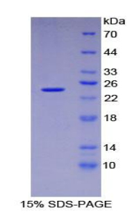 蓬乱蛋白Dsh同源物1(DVL1)重组蛋白,Recombinant Dishevelled, Dsh Homolog 1 (DVL1)