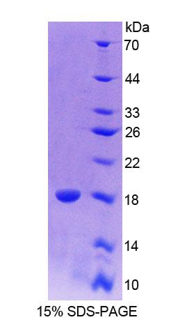 配对框基因6(PAX6)重组蛋白,Recombinant Paired Box Gene 6 (PAX6)