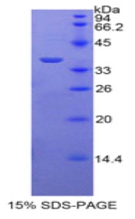 旁血小板溶蛋白(PPL)重组蛋白,Recombinant Periplakin (PPL)