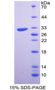 盤狀結構域受體家族成員2(DDR2)重組蛋白,Recombinant Discoidin Domain Containing Receptor 2 (DDR2)