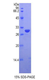 牛痘相关激酶1(VRK1)重组蛋白,Recombinant Vaccinia Related Kinase 1 (VRK1)