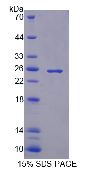 凝血因子ⅩⅢB肽(F13B)重組蛋白,Recombinant Coagulation Factor XIII B Polypeptide (F13B)