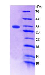 凝血因子ⅩⅢA1肽(F13A1)重组蛋白,Recombinant Coagulation Factor XIII A1 Polypeptide (F13A1)