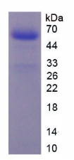 凝血因子Ⅹ(F10)重组蛋白,Recombinant Coagulation Factor X (F10)