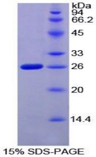 凝血因子Ⅷ关联蛋白1(F8A1)重组蛋白,Recombinant Coagulation Factor VIII Associated Protein 1 (F8A1)