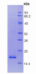 凝血因子Ⅷ(F8)重組蛋白,Recombinant Coagulation Factor VIII (F8)