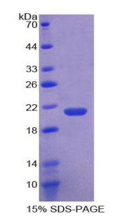 凝血因子Ⅱ(F2)重组蛋白,Recombinant Coagulation Factor II (F2)