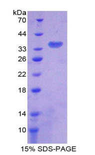 柠檬酸合酶(CS)重组蛋白,Recombinant Citrate Synthase (CS)