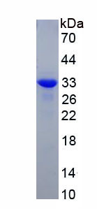 镍纹蛋白(METRN)重组蛋白,Recombinant Meteorin (METRN)