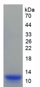 尿酸盐转运蛋白1(URAT1)重组蛋白,Recombinant Urate Transporter 1 (URAT1)